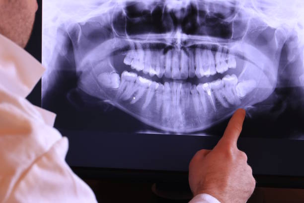 Best Emergency Treatment for Toothache in Boulder City, NV